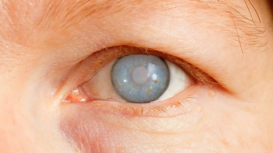 Benessere della vista ed esercizi oculari
